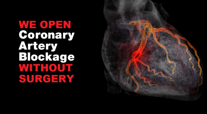 Coronary Artery Blockage