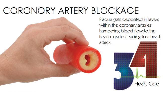 Coronary Artery Blockage is a main cause of Heart Attack