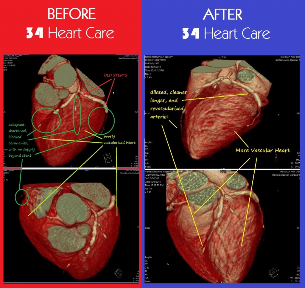 Yogesh Mathur Before & After Treatment Comparison