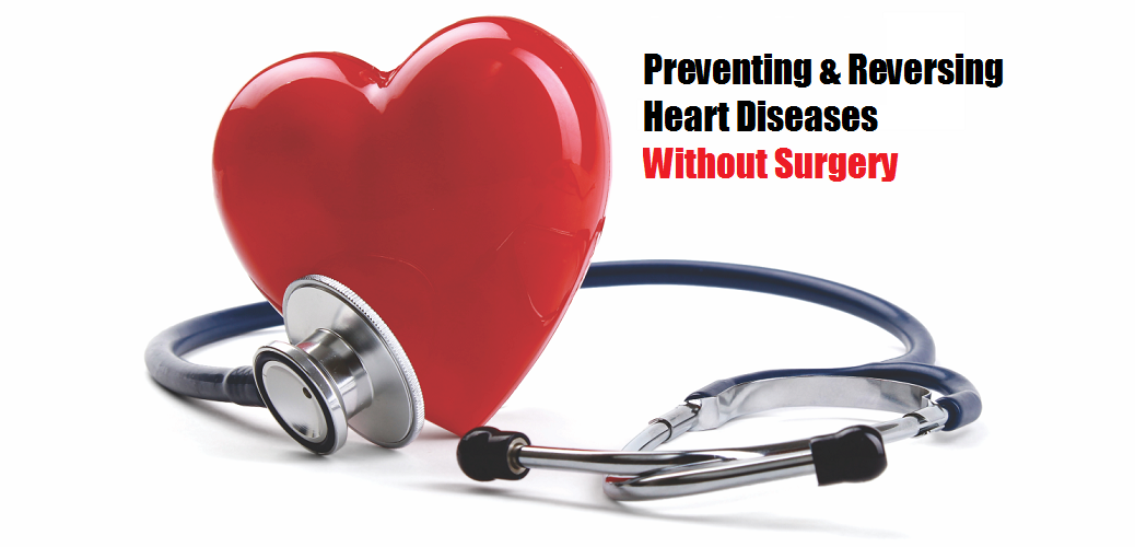 Prevent and Reverse Heart Disease Without Surgery