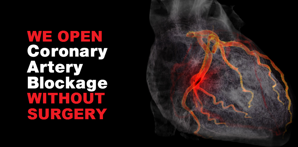 Coronary Artery Disease Blockage