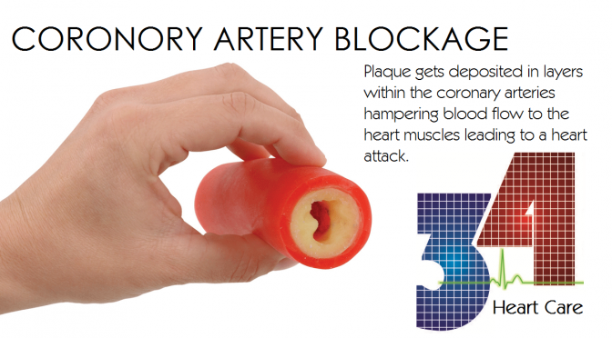 Prevent Heart Attacks by Removing Blockages