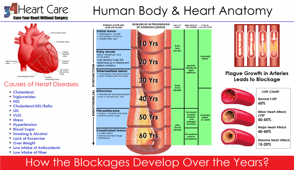 Blockage Human Age Correlation 34 HEART CARE